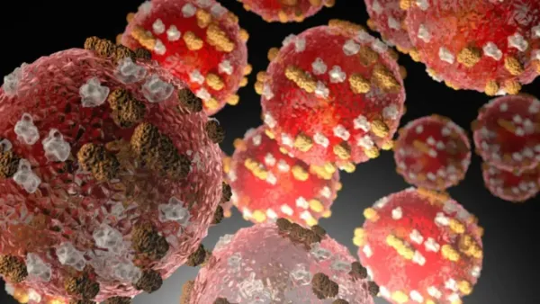 新西兰麻疹疫情升级,惠灵顿已成重灾区,密接者数百