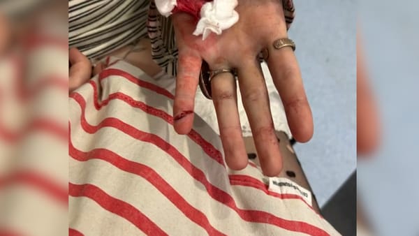 血迹斑斑：女孩在奥克兰火车站遭群殴