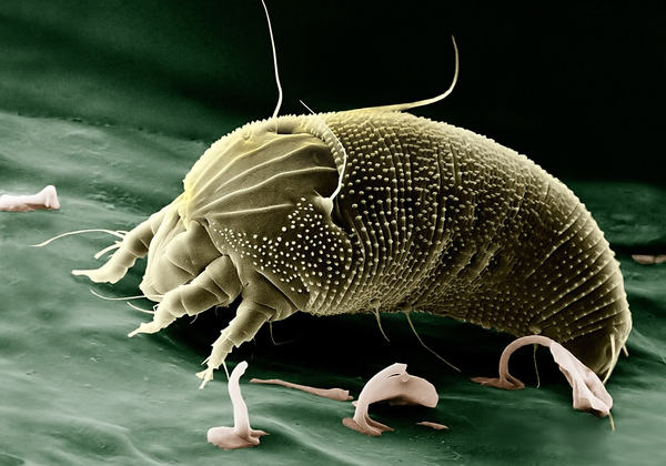 dust-mite-allergy