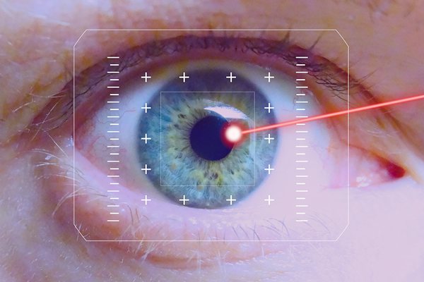 laser-eye-correction-surgery